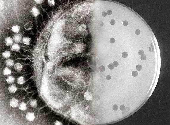 zoomed in view of microorganisms