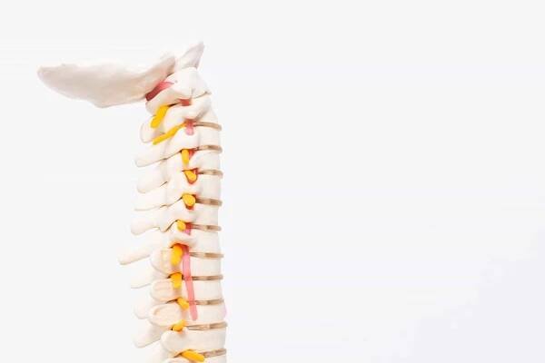 Model krční páteře s krevními cévami na bílém pozadí. Koncept Lordosis a spondylosis krční páteře — Stock obrázek