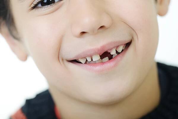 Jak vypadají mléčné zuby? - DentalCare