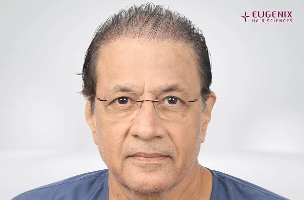 Arun Govil Front Post - Op