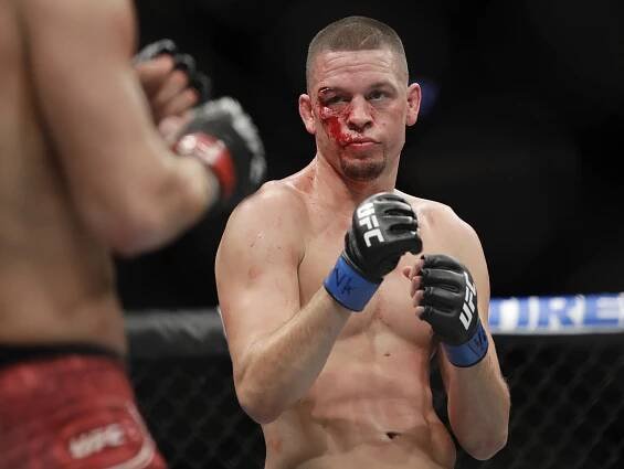 Nate Diaz
