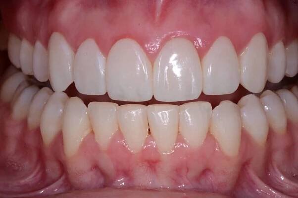 Smile Gallery Cherrywood Dental Care