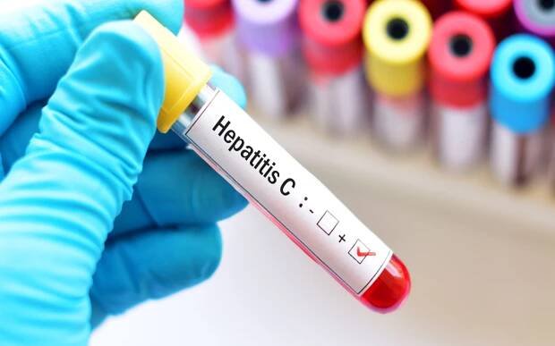 Virová nebo bakteriální infekce? CRP test rychle zjistí z pár kapek krve. istock.com