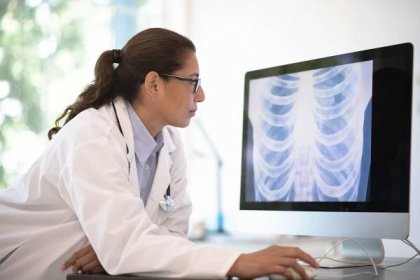 žena lékař spekuluje na rentgenovém snímku - rentgenové záření monitorovací zařízení - stock snímky, obrázky a fotky