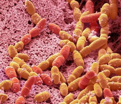 Streptococcus mutans, SEM