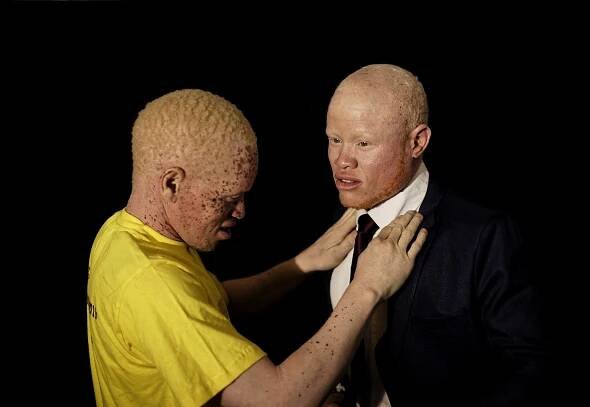 Kenya Albino Beauty Pageant