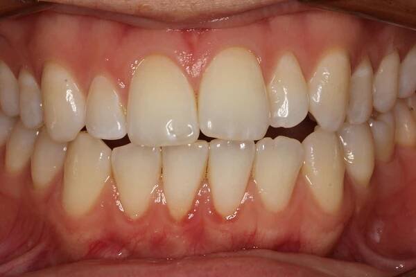 Before and After • 425 Dental