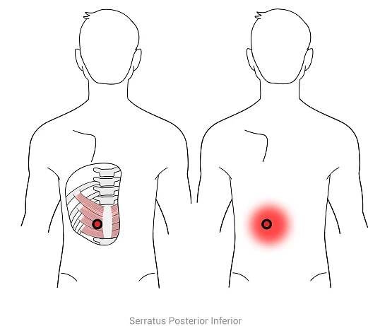 Trigger Points System