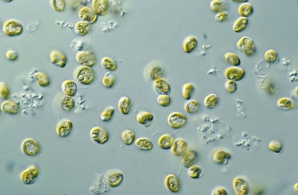 Algae bioreactor