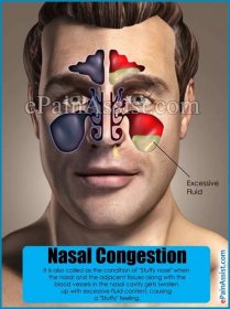 Home Remedies For Nose Congestion Cheapest Purchase, Save 44% | jlcatj ...