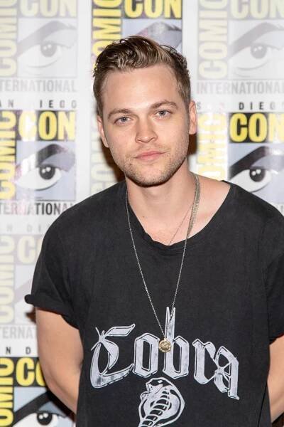 50 Famous Celebrities With Asymmetrical Faces