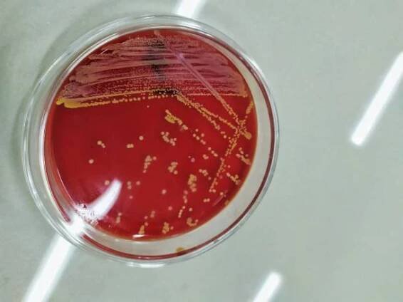 kultura streptococcus aureus - gangréna - stock snímky, obrázky a fotky