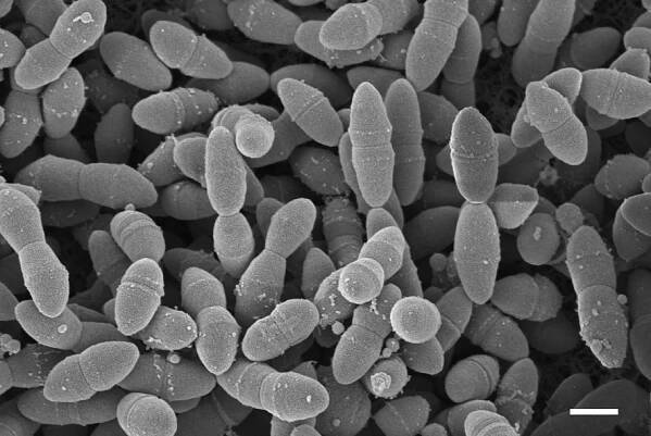 RKI - Pneumokokken-Infektionen (Streptococcus pneumoniae)