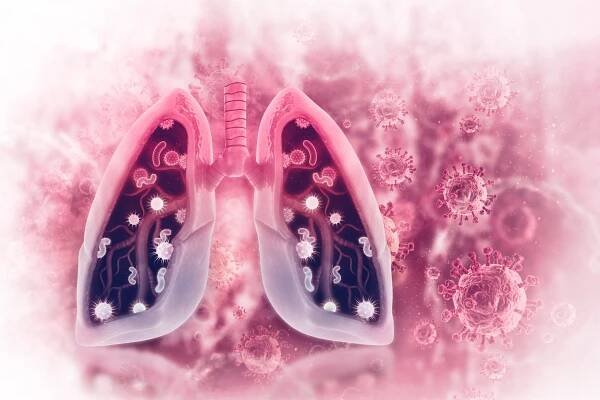 Epidemiologie intersticiálních plicních procesů – 1. díl