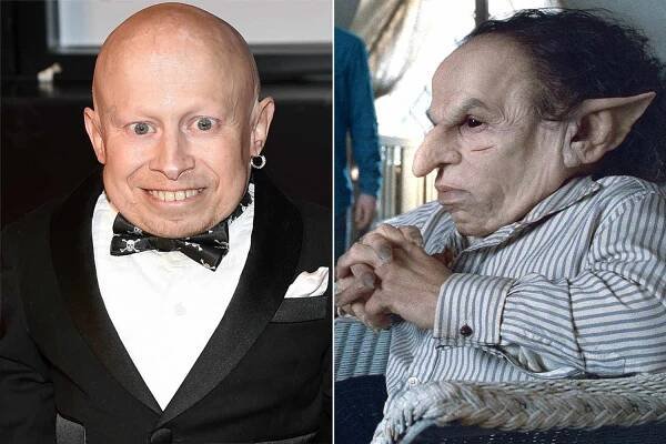 Harry Potter Actors Who Died