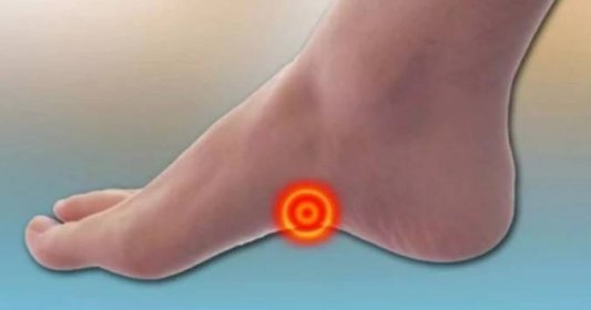 Drásavá bolest klenby nohy a její dopad na zdraví chodidla: Doživotním následkům se podle odborníků zamezí pouze včasným odhalením