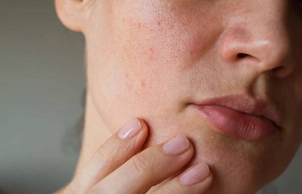 Dry Mouth At Night: What Causes It and How to Prevent It