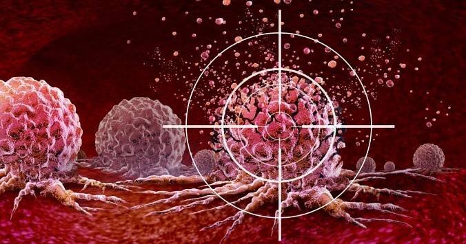 Lymfomy. Novinková léčba nádorů cílenou imunologickou terapií pohledem pacientky i lékaře