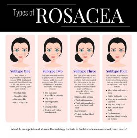 Rosacea - hlavní příznaky. Jak léčit růžovku?