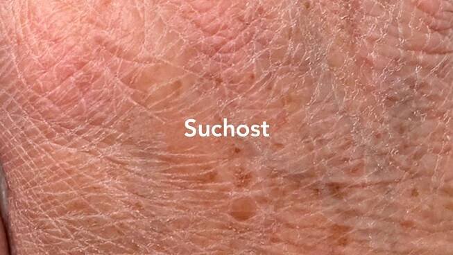 suchost