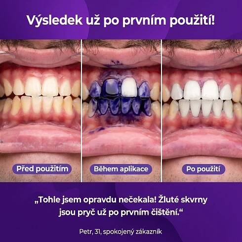 Bělicí korektor V34