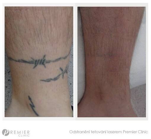 Reference - Premier Clinic