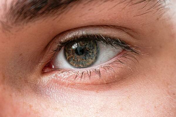 The Silent Thief of Sight - What is glaucoma? - White Orchid Insights
