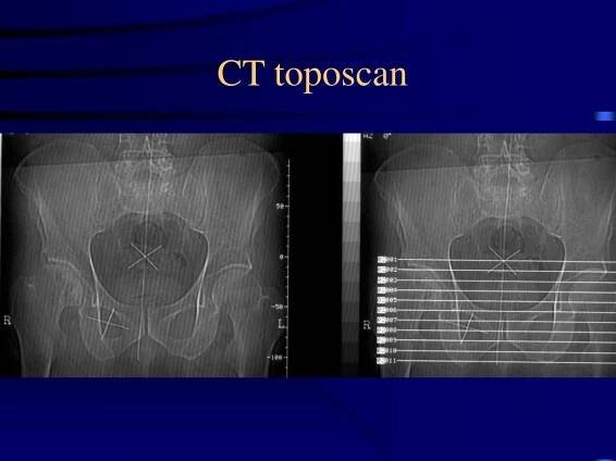 PPT - CT zaměření PowerPoint Presentation, free download - ID:4191818