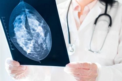 lékařka, která se dívá na výsledky mamografie na rentgenovém snímku - mamografie - stock snímky, obrázky a fotky