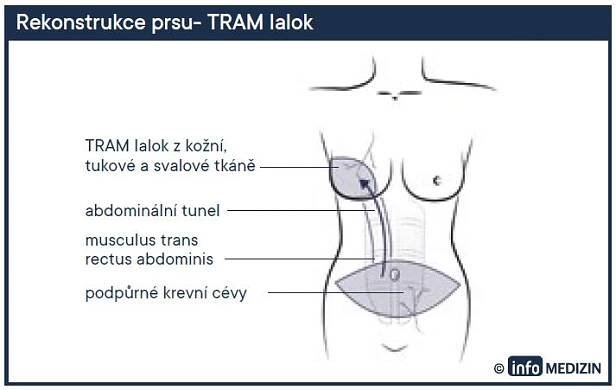 rekonstrukce-2