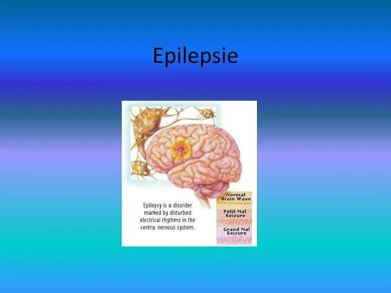 PPT - Epilepsie PowerPoint Presentation, free download - ID:4943907
