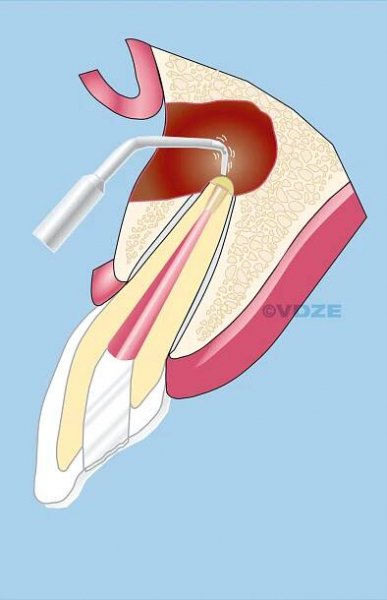 CHIRURGIE_3