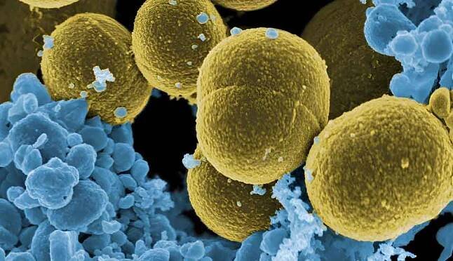 Staphylococcus aureus Bakterien entkommen hier weißen Blutzellen. 2021 sind 130.000 Menschen wegen Antibiotika-Resistenzen an einer Infektion mit diesen Bakterium verstorben.