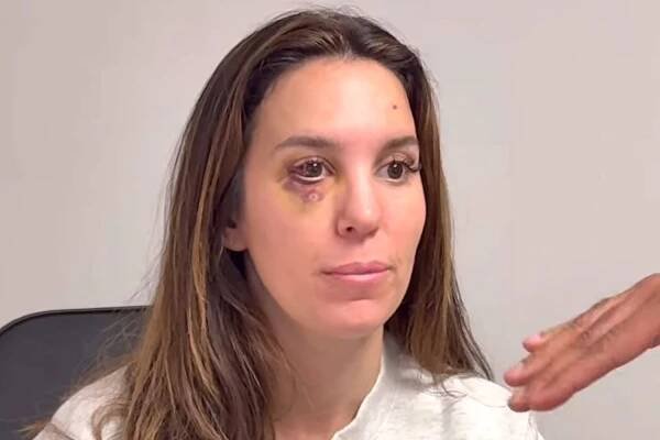 Christy Carlson Romano Says Bullet Fragment Was ‘Less Than 1 Millimeter’ from ‘Permanently Blinding’ Her