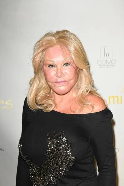 Jocelyn Wildenstein byla pro mnohé odstrašujícím případem.