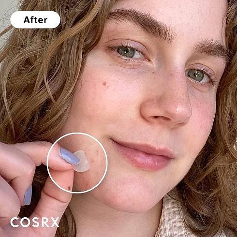 Cosrx Acne Pimple Master 24 Patches 6