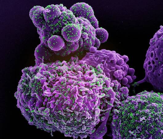 How COVID-19 Silently Sabotages the Human Immune System