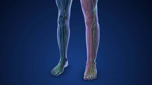 medical animation depicting limb lymphedema - diabetická noha - stock snímky, obrázky a fotky