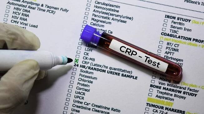 CRP test neukáže jen bakteriální infekci. Může odhalit i potíže se srdcem