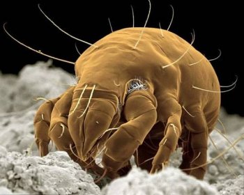 Paraziti, kteří žijí v posteli a v jejich blízkosti / na světě | Užitečné tipy a zajímavé informace o jakémkoli tématu.