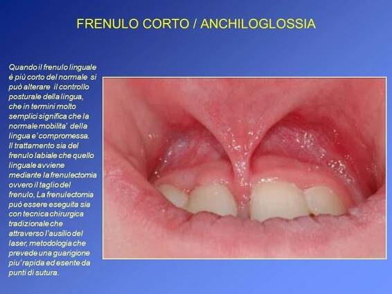Patologie orali pediatriche » Dott. Mariani Umberto || Patologia orale e Medicina