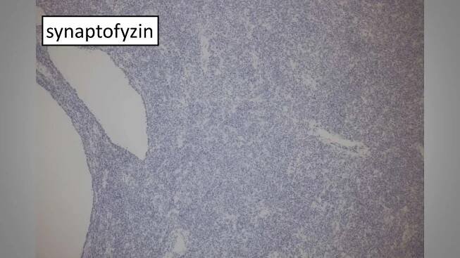 synaptofyzin
 