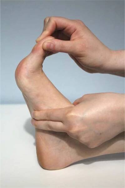 Plantar Fasciitis | AAFP