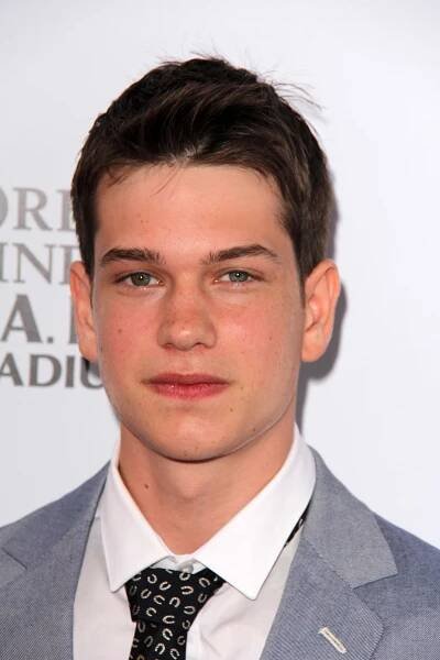 56 Celebrities With Beauty Mark (Moles)