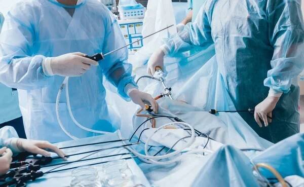 Proces operace gynekologické operaci laparoskopickou technikou. Skupina lékařů v operační místnosti s vybavením chirurgie. Pozadí — Stock obrázek
