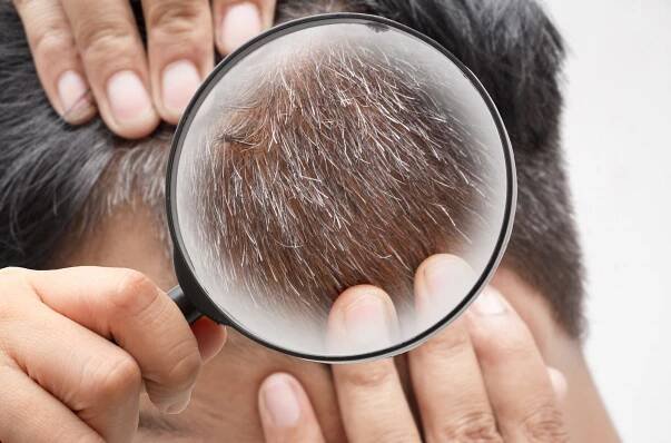 Why my hair is changing, and what I can do about it - In The Dogbox