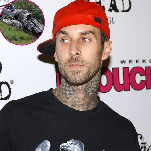 Travis Barker’s Health Scares, Injuries Through the Years