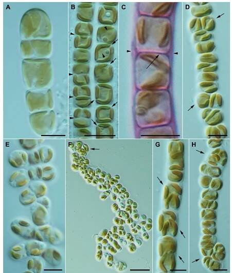 Figure 9. Nematochrysis sessilis var. vectensis. A. Short filament with 1 deeply bilobed chloroplast or two chloroplasts. Scale bar=5 wm. B. Two parallel filaments. Left filament shows daughter with transverse cell divi- sion (arrowheads). Right filament showing pre-cell division with diagonal chloroplast division (arrows). Note the pyrenoid-like structures on the left filament (arrowheads). Scale bar=5 wm. C. Fused cell walls (arrow) and a filament sheath (arrowheads) stained with ruthenium red. Scale bar=5 ym. D. Lateral cell division (arrows) in an early stage of multiseriate filament formation. Scale bar=5 um. E. Early stage of palmella formation where the multiseriate filament has a brush-like appearance. Scale bar =5 wm. F. Palmella stage with irregularly organized cells. Note also the aplanospore sporangium (arrow). Scale bar =20 wm. G. Early stage of aplanospore forma- tion with two cells per future sporangium (arrows). Scale bar=5 zm. H. More advanced stage of aplanospore sporangium development with several cells inside the sporangia (arrows). Scale bar=5 jm. (For interpretation of the references to color in this figure legend, the reader is referred to the web version of this article.) 