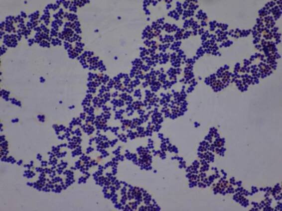 fialové bakterie staphylococcus aureus ve tvaru koku pod složeným mikroskopem - staphylococcus - stock snímky, obrázky a fotky