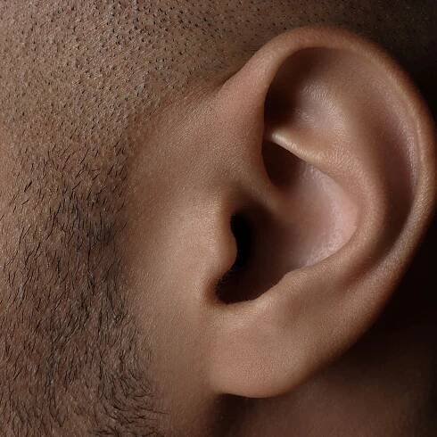 Prominent Ears in Scotland | Plastic & Cosmetic Surgery Aberdeen